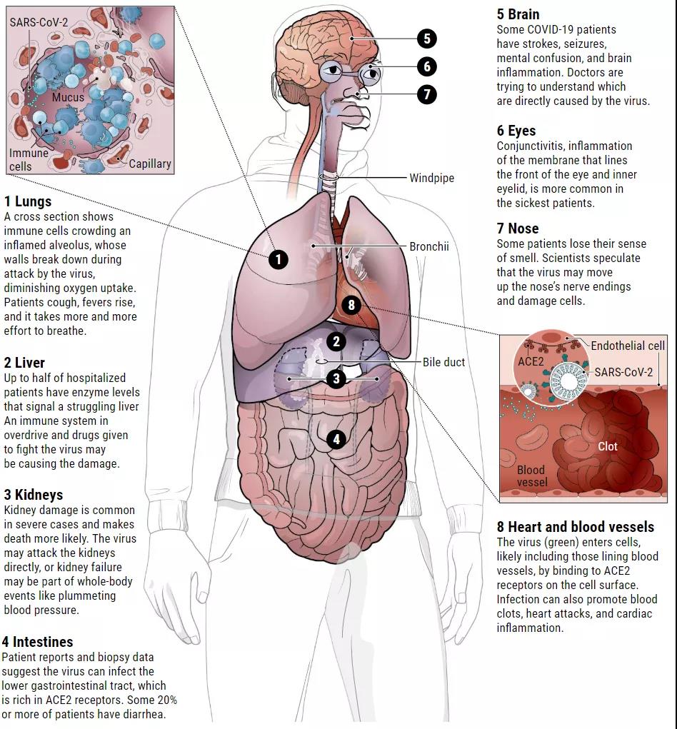 多脏器损伤 越来越多的证据显示,部分新冠肺炎患者出现加重,与细胞